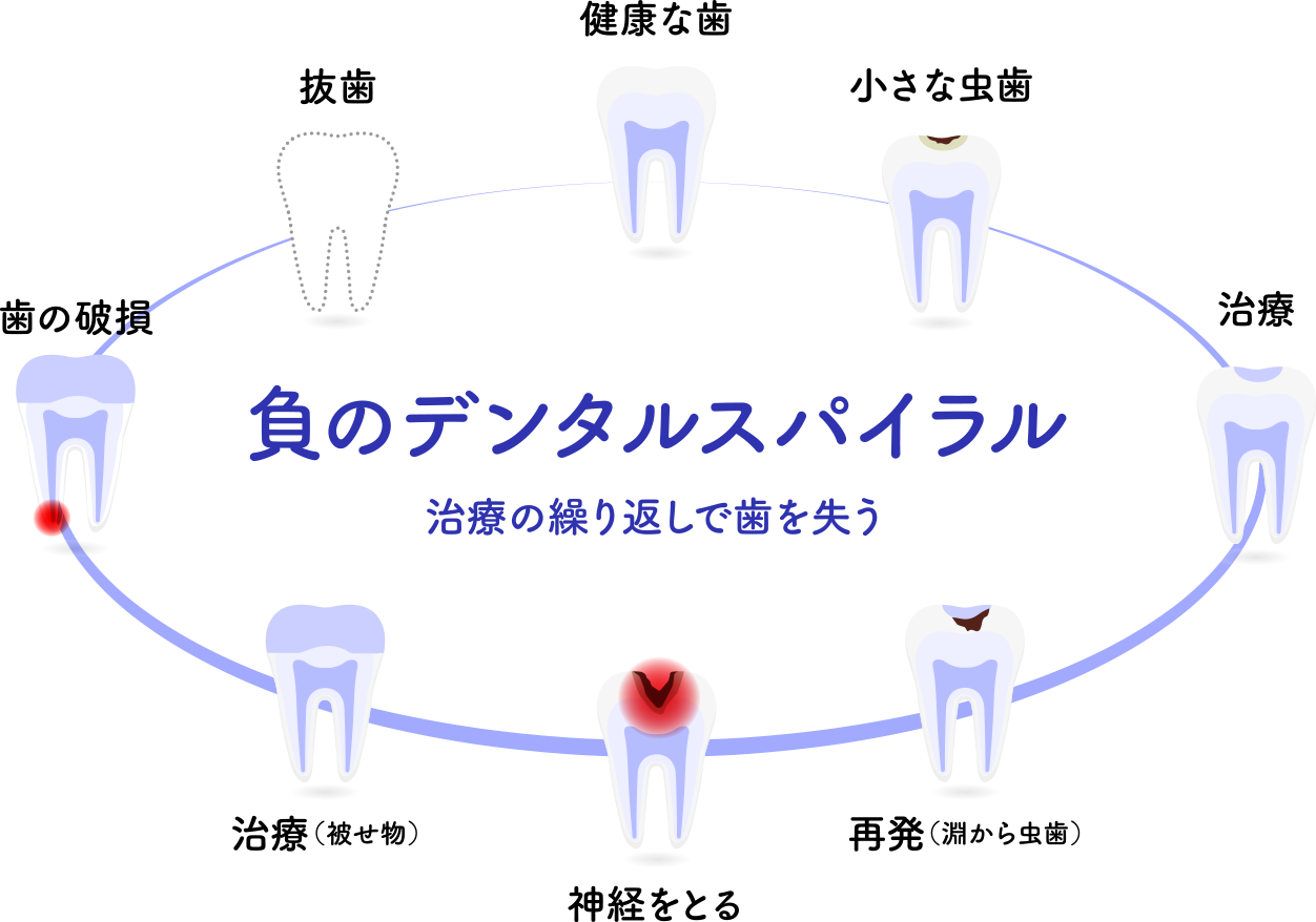 負のデンタルスパイラル